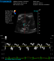 High frequency ultrasound imaging